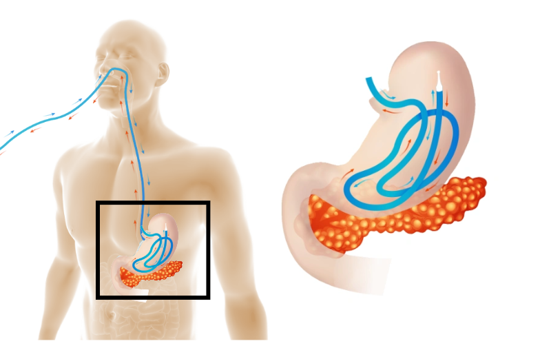 Step2-w-model Arctx Medical Logo No Text